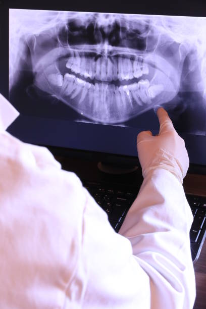 Best Emergency Dental Extractions in Chandler, TX