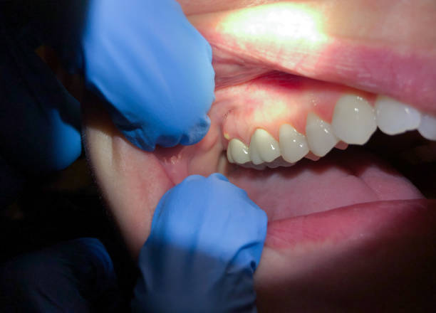 Best Pediatric Emergency Dentist in Chandler, TX