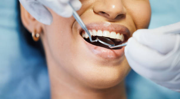 Best Broken or Cracked Tooth Emergency Dentist in Chandler, TX