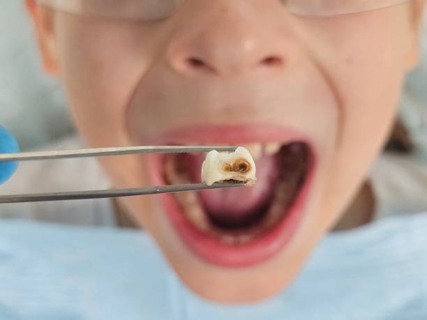 Best Emergency Dental Services for Seniors in Chandler, TX